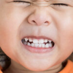 علت دندان قروچه کودکان، ۷ علت اصلی و روش‌های درمان آن
