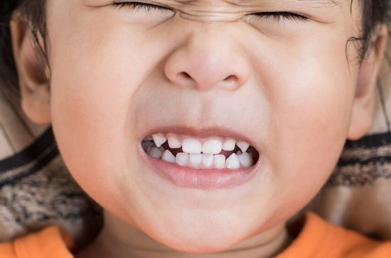 دلایل دندان قروچه و روش درمان آن